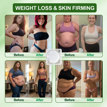 🇺🇸𝑶𝒇𝒇𝒊𝒄𝒊𝒂𝒍 𝑺𝒕𝒐𝒓𝒆 | 𝐀𝐌𝐙𝐊𝐄𝐄𝐏® 𝑴𝒆𝒕𝒂𝒃𝒐𝒍𝒊𝒄 𝑵𝒂𝒏𝒐 𝑴𝒊𝒄𝒓𝒐𝒏𝒆𝒆𝒅𝒍𝒆 𝑷𝒂𝒕𝒄𝒉 (𝐉𝐮𝐬𝐭 𝐨𝐧𝐜𝐞 𝐚 𝐝𝐚𝐲, 𝐯𝐢𝐬𝐢𝐛𝐥𝐞 𝐜𝐡𝐚𝐧𝐠𝐞𝐬 𝐢𝐧 𝟕 𝐝𝐚𝐲𝐬）𝘽𝙚𝙧𝙗𝙚𝙧𝙞𝙣𝙚 + 𝙈𝙤𝙧𝙞𝙣𝙜𝙖 𝙁𝙤𝙧𝙢𝙪𝙡𝙖 ✅ 𝐅𝐨𝐫 𝐨𝐛𝐞𝐬𝐢𝐭𝐲, 𝗟𝗼𝗼𝘀𝗲 𝘀𝗸𝗶𝗻,𝐝𝐢𝐚𝐛𝐞𝐭𝐞𝐬, 𝐬𝐥𝐞𝐞𝐩 𝐚𝐩𝐧𝐞𝐚, 𝐣𝐨𝐢𝐧𝐭 𝐢𝐬𝐬𝐮𝐞𝐬 𝐚𝐧𝐝 𝐦𝐨𝐫𝐞