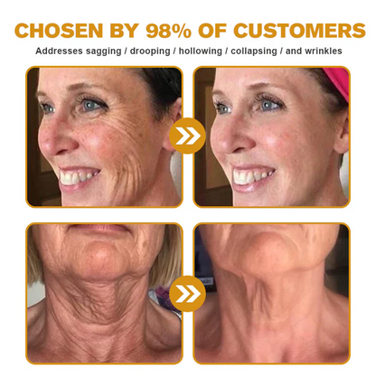 Daasry® Botox Bee Venom Skin Restoration Cream - Anti-aging, Hydrating, Skin Firming & Lifting, Skin Repair, Even Tone, Acne and Dark Spot Treatment, Wart and Mole Removal, and Psoriasis Relief.