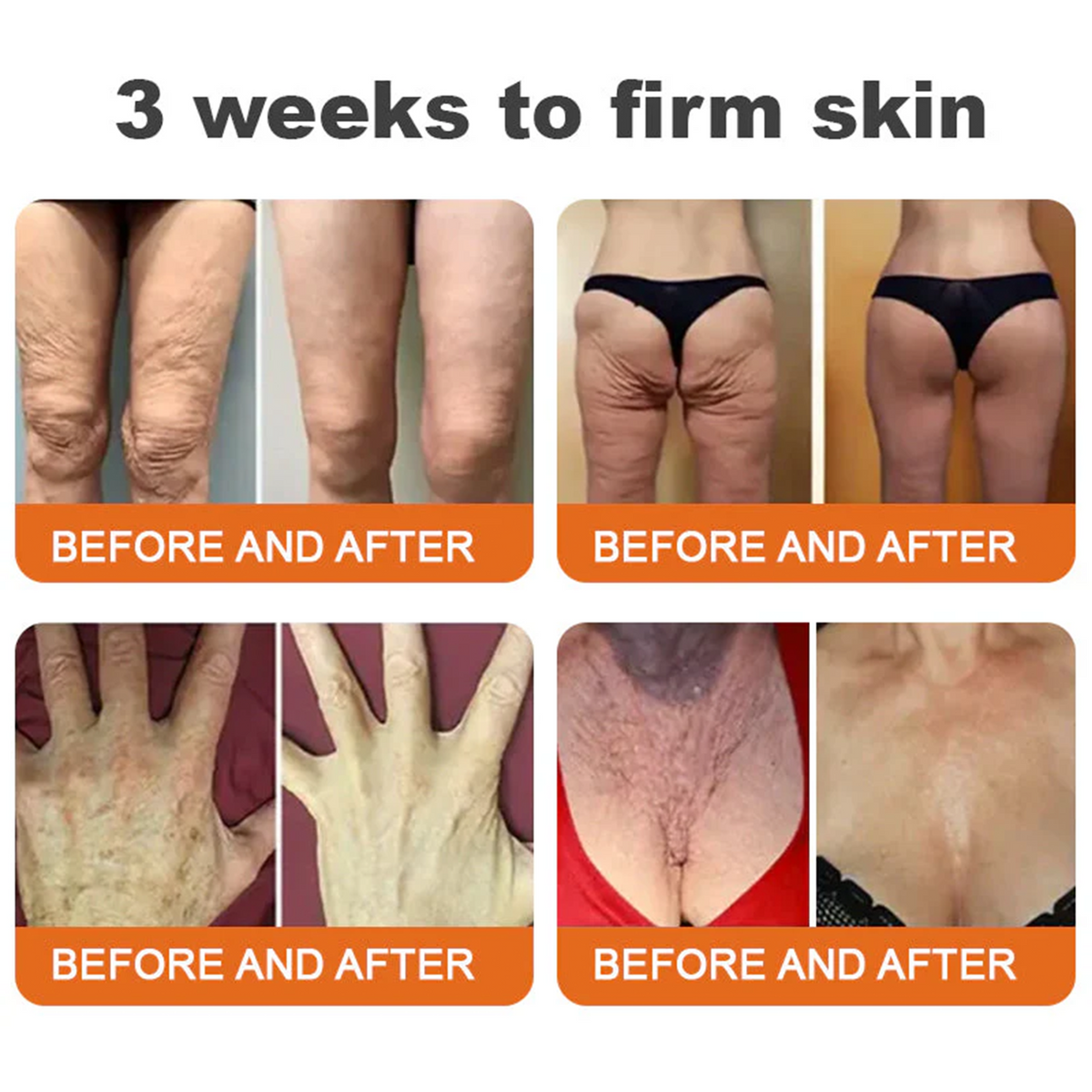 Daasry® Botox Bee Venom Skin Restoration Cream - Anti-aging, Hydrating, Skin Firming & Lifting, Skin Repair, Even Tone, Acne and Dark Spot Treatment, Wart and Mole Removal, and Psoriasis Relief.