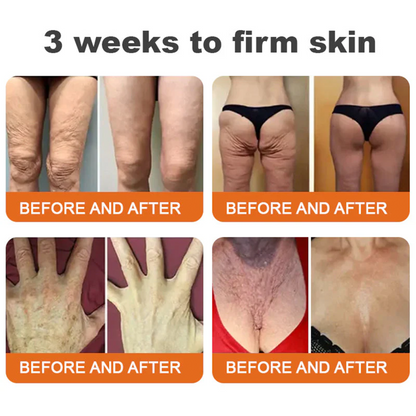 Daasry® Botox Bee Venom Skin Restoration Cream - Anti-aging, Hydrating, Skin Firming & Lifting, Skin Repair, Even Tone, Acne and Dark Spot Treatment, Wart and Mole Removal, and Psoriasis Relief.