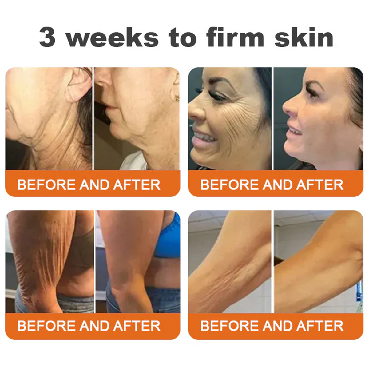 Daasry® Botox Bee Venom Skin Restoration Cream - Anti-aging, Hydrating, Skin Firming & Lifting, Skin Repair, Even Tone, Acne and Dark Spot Treatment, Wart and Mole Removal, and Psoriasis Relief.